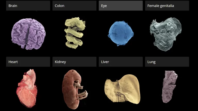 Atlas de órganos humanos: La revolución del "Google Earth" anatómico