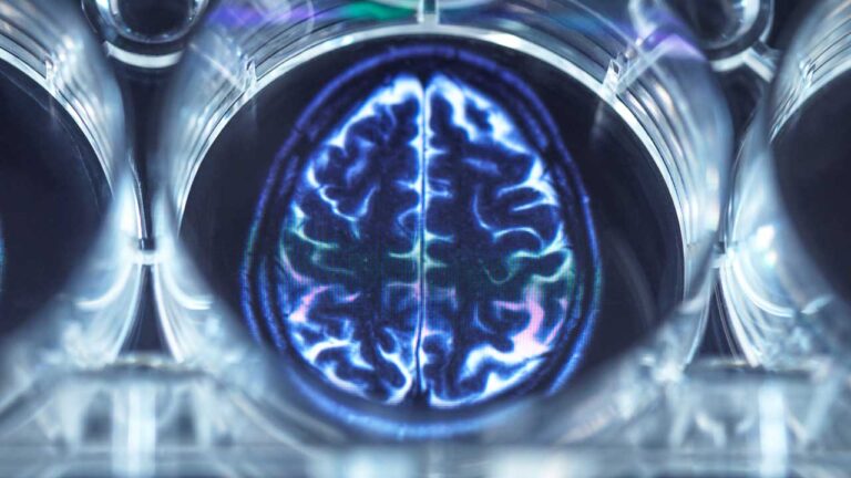 Bioenergética del cerebro humano: La UNAM ratifica el alto costo metabólico de la cognición