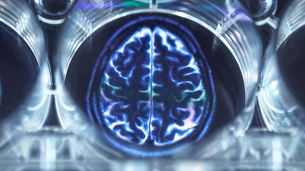 Bioenergética del cerebro humano: La UNAM ratifica el alto costo metabólico de la cognición